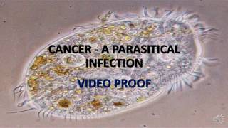 VIDEO PROOF CANCER IS CAUSED BY PARASITES [upl. by Alderman]