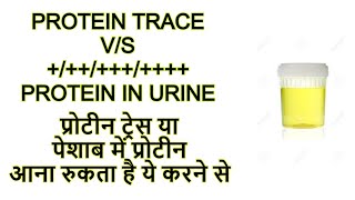 protein trace in urine vs protein  प्रोटीन ट्रेस या पेशाब में प्रोटीन आना रुकता है ये करने से [upl. by Oedama]