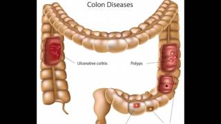 What is Bifidobacterium Infantis [upl. by Sivie960]