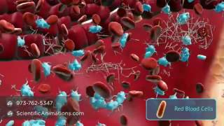 Angiogenesis Formation of new blood vessels [upl. by Ellerahc]