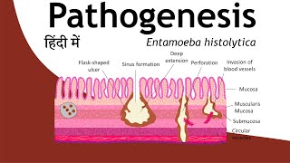 Pathogenesis of Entamoeba histolytica in Hindi  Parasitology Hindi  Basic Science Series [upl. by Maxentia]