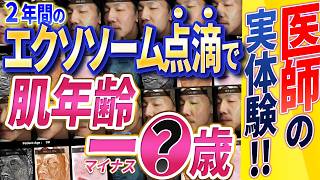 【衝撃の結末】エクソソームを医師が2年間使い続けた結果が超やばいです [upl. by Everest500]