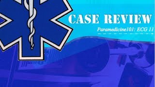 Paramedicine101 ECG Case 11 [upl. by Fabe]