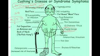 Cushing syndrome Dexamethasone suppression test explained [upl. by Aisatsana]