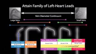 Attain®Ability Straight Model 4196 Left Heart Lead for CRT Implantation  small to medium For impl [upl. by Elvis]