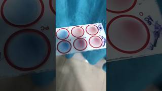 Agglutination test mixing procedure [upl. by Nosemaj]