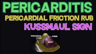 Pericarditis  Pericardial Friction Rub and Kussmaul Sign  EXPLAINED [upl. by Kean]