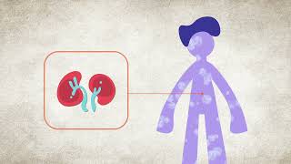 High Potassium Hyperkalemia  Symptoms amp Causes  National Kidney Foundation [upl. by Eveleen]