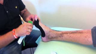 Kinesio tape for Hallux Valgus [upl. by Ande]