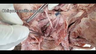 Suboccipital triangle  Dissection [upl. by Garek]