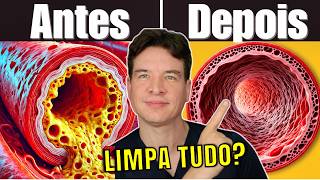 LIMPA as Artérias Entupidas SEM REMÉDIOS [upl. by Korie161]