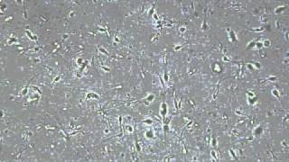 Asthenozoospermia  ruch w miejscu2avi [upl. by Isla]