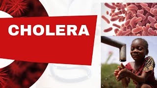 CHOLERA SYMPTOMS amp TREATMENT WHAT YOU NEED TO KNOW 2024 [upl. by Ane767]