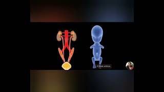 Bladder Exstrophy  Animation  Lecture  English  Hindi [upl. by Ttessil]