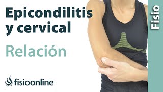 Epicondilitis y su relación con la zona cervical o vértebras cervicales [upl. by Imogen277]