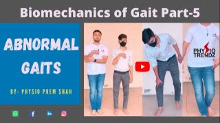 Antalgic gait Hemiplegic gait All Abnormal Gait Demonstration Gait biomechanics [upl. by Martres]