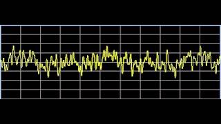 Thalamic Diseases  Rife Frequencies [upl. by Karole]