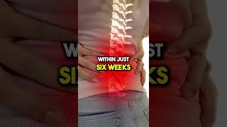 Can You Heal a Herniated Disc backpainrelief bobandbrad herniateddisc painrelief healthtips [upl. by Ferreby]