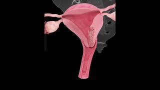 Understanding The Endometrial Cancerwomenhealtbiologyscience viralshorts [upl. by Tteragram]