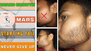 BEARD GROWTH  Beard growth journey failed in the beginning 😢  Never give up  Mars by ghc [upl. by Norac273]