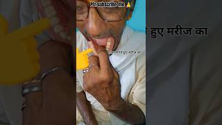 touching rpd teeth to patient DentalXYZ trending viralshort reels plesesubscribe 🙏🙏🙏⚕️ [upl. by Jahn]