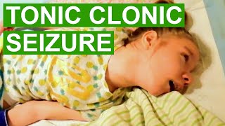 Tonic Clonic Seizure Video [upl. by Allain]