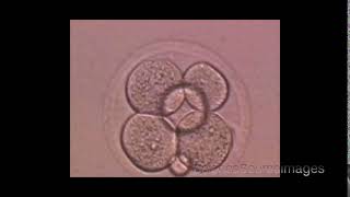 Developing human embryo microscope view [upl. by Shane677]