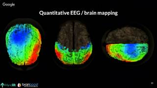 Fundamentals of Neurofeedback Webinar [upl. by Nanni]