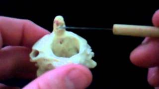 Vertebral Column Bone VideoMP4 [upl. by Parish]