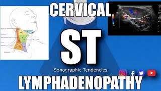 Sonoquickies  Cervical Lymphadenopathy [upl. by Saideman19]