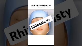 Rhinoplasty surgery shorts mbbs medical rhinoplasty [upl. by Askwith]