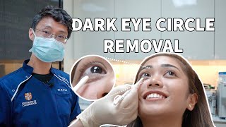 Rejuran I Treatment For Dark Eye Circles and Eyebags [upl. by Yenetruoc]