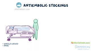 Application of Anti embolic device and sequential compression  Nursing  Osmosis [upl. by Caplan158]