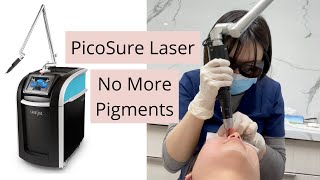 My PicoSure Experience bye bye freckles and pigmentations How does PicoSure laser works [upl. by Yadroc741]