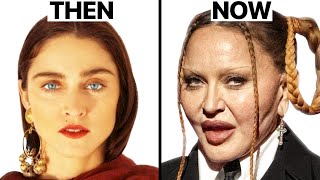 Madonna Plastic Surgeries  Surgeon Reacts [upl. by Ecilegna]