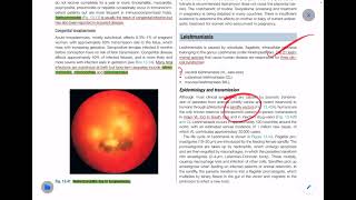 Infectious Disease Davidsons Principles and Practice of Medicine  FCPS  MRCP Lecture01 [upl. by Auqinehs]