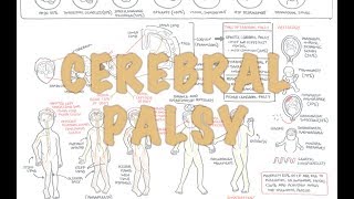 Cerebral Palsy  DETAILED Overview [upl. by Salohcim552]