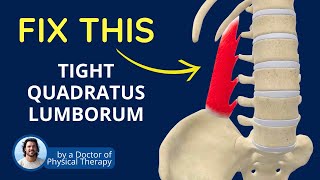 Is a Tight QL Causing Your Back Pain  Quadratus Lumborum Muscle Tightness [upl. by Airdna]