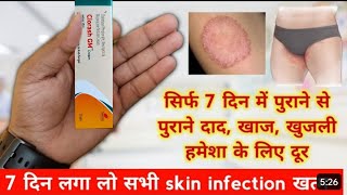 clorash gm cream  antifungal cream  दाद खाज खुजली की दवाई  क्लोराश जीएम क्रीम [upl. by Gnahc]