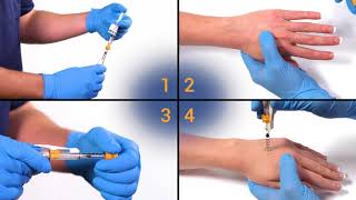 Needle Free Injection the JTip Training Video [upl. by Ahselat]