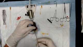 Orchidectomy surgery preformed by Dr Bowen [upl. by Champagne267]