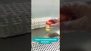 Urine exam fluid process [upl. by Audra998]