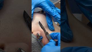 Dermaplane MoniqueAbbadie with me asmr dermaplaning smoothskin miamispa medspa skincare [upl. by Xonel]