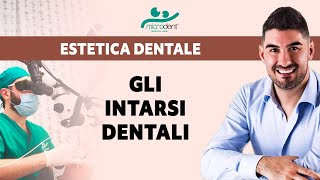 Intarsi Dentali in 2 ore TECNOLOGIA DENTALE  CEREC  Dentista Bologna Microdent [upl. by Seditsira244]