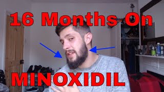 Minoxidil Beard Growth Results  Month 16 on Minox for the Beard  TheJourneyContinues [upl. by Ennire]