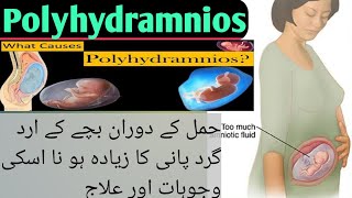 Polyhydramnios Pregnancy Causes symptoms amp Treatment [upl. by Linette520]