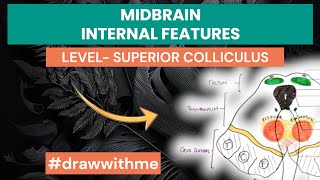 Midbrain Cross Sectional Anatomy  Internal features  level of Superior Colliculus [upl. by Heiney]