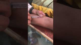 Iv Injection lagane Ka sahi tarika ll new video for injection ll 2024 ll doctor nursing trending [upl. by Som958]