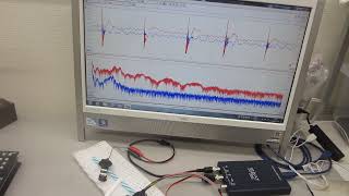 超音波プローブの伝搬特性テスト－－低周波の共振現象と、高周波の非線形現象を発振制御するメガヘルツの超音波システム技術ーー（超音波システム研究所） [upl. by Bettye874]