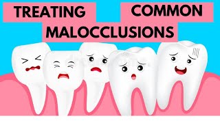 Management of Common Malocclusions Orthodontics [upl. by Eenad]